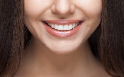 Professional Teeth Whitening: Reasons, Benefits, Types & Cost