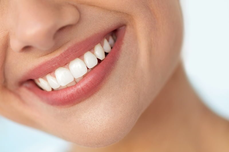 Dental Bonding: The Ottawa Guide to Composite Bonding for Teeth