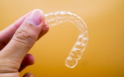 Invisalign Clear Aligners: An Ottawa Buyers Guide
