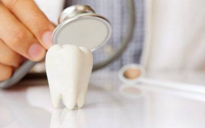 What To Do If You Have A Cracked Molar
